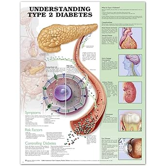 Understanding Type 2 Diabetes Anatomical Chart