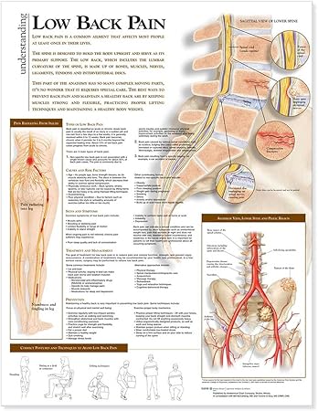 Understanding Low Back Pain Anatomical Chart