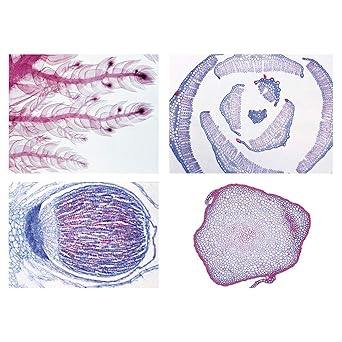 3B Scientific GmbH W13014 Bryophyte (Liverworts and