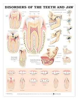 Disorders of the Teeth and Jaw Anatomical Chart