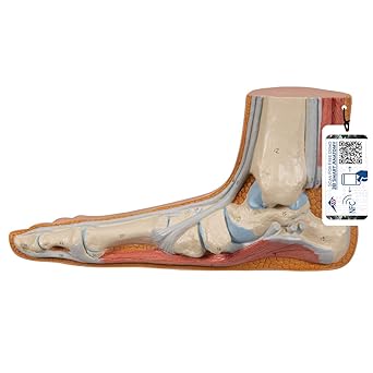 3B Scientific M31 Flat Foot (Pes Panus) - 3B Smart Anatomy