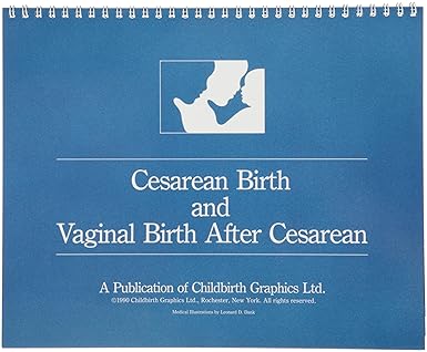 HEALTH EDCO W43156 Cesarean Birth and Vaginal Birth After Cesarean Flip Chart, 10-1/2