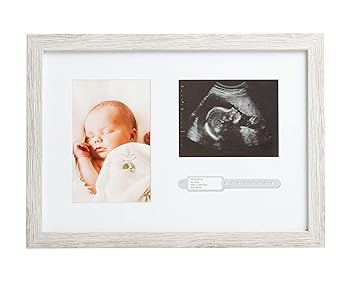 Kate & Milo Rustic Bracelet ID and Sonogram Frame, Rustic Pregnancy Keepsake Picture Frame, Gender-Neutral Nursery Décor